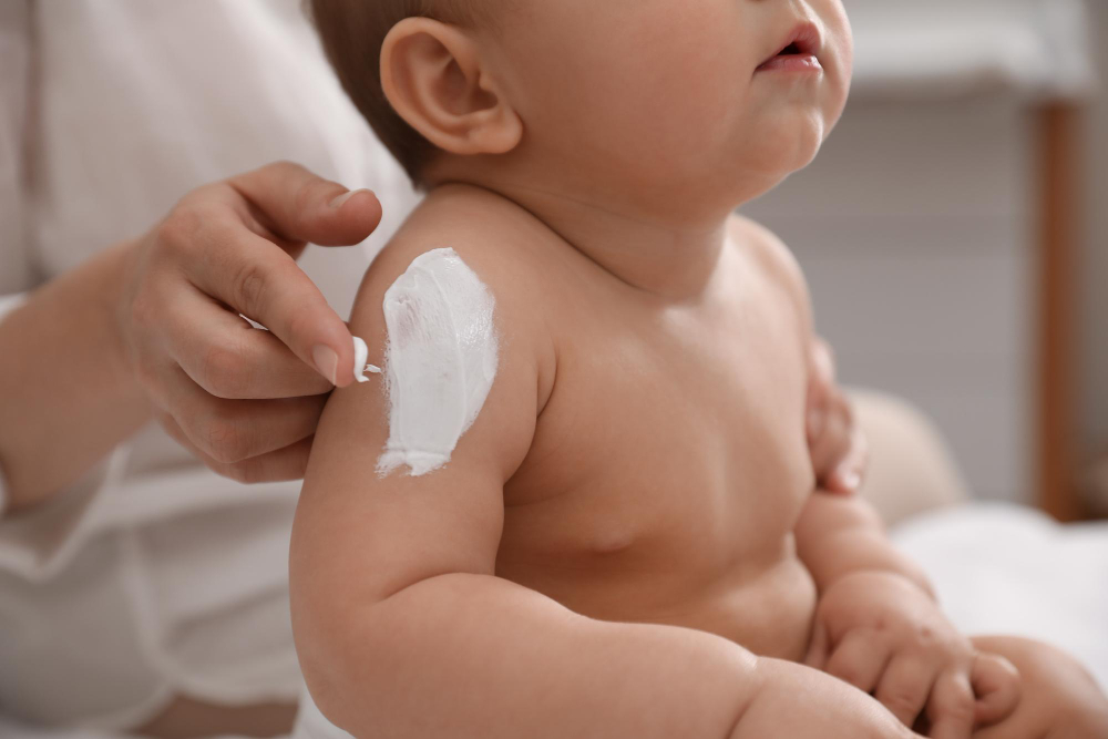Cuidados de la piel de bebés y niños